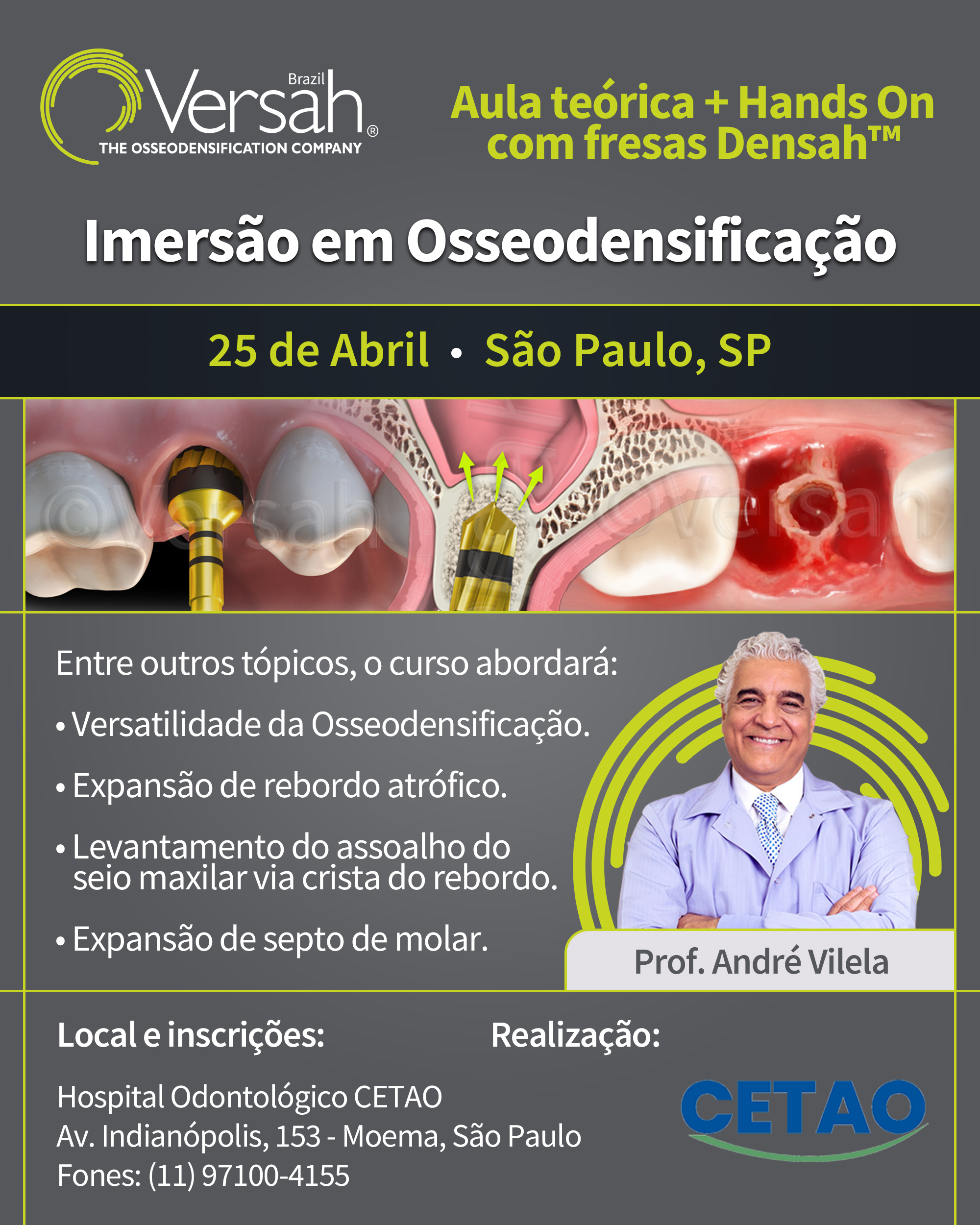 Osseodensificação Hospital Odontológico CETAO