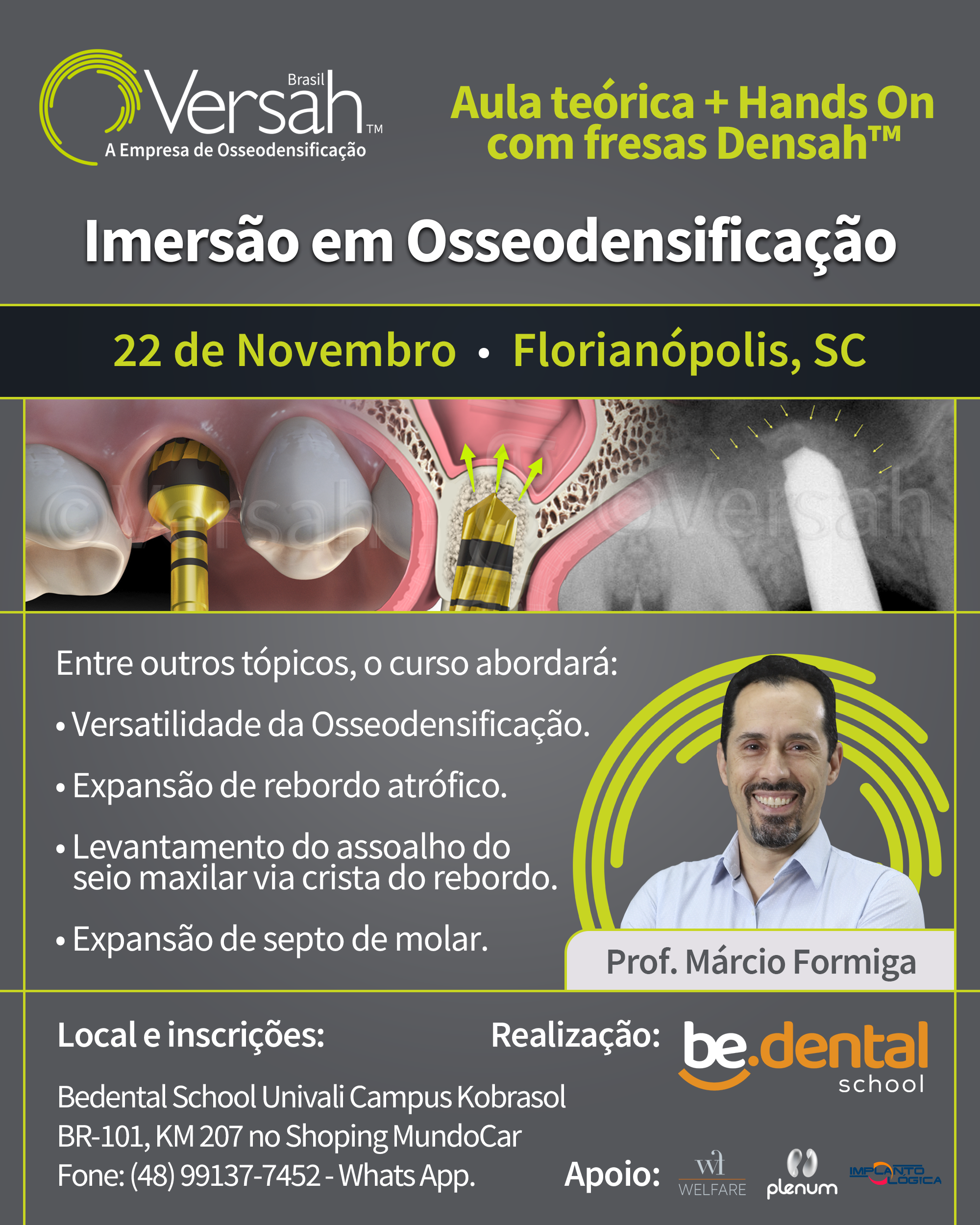 Osseodensificação BeDental School