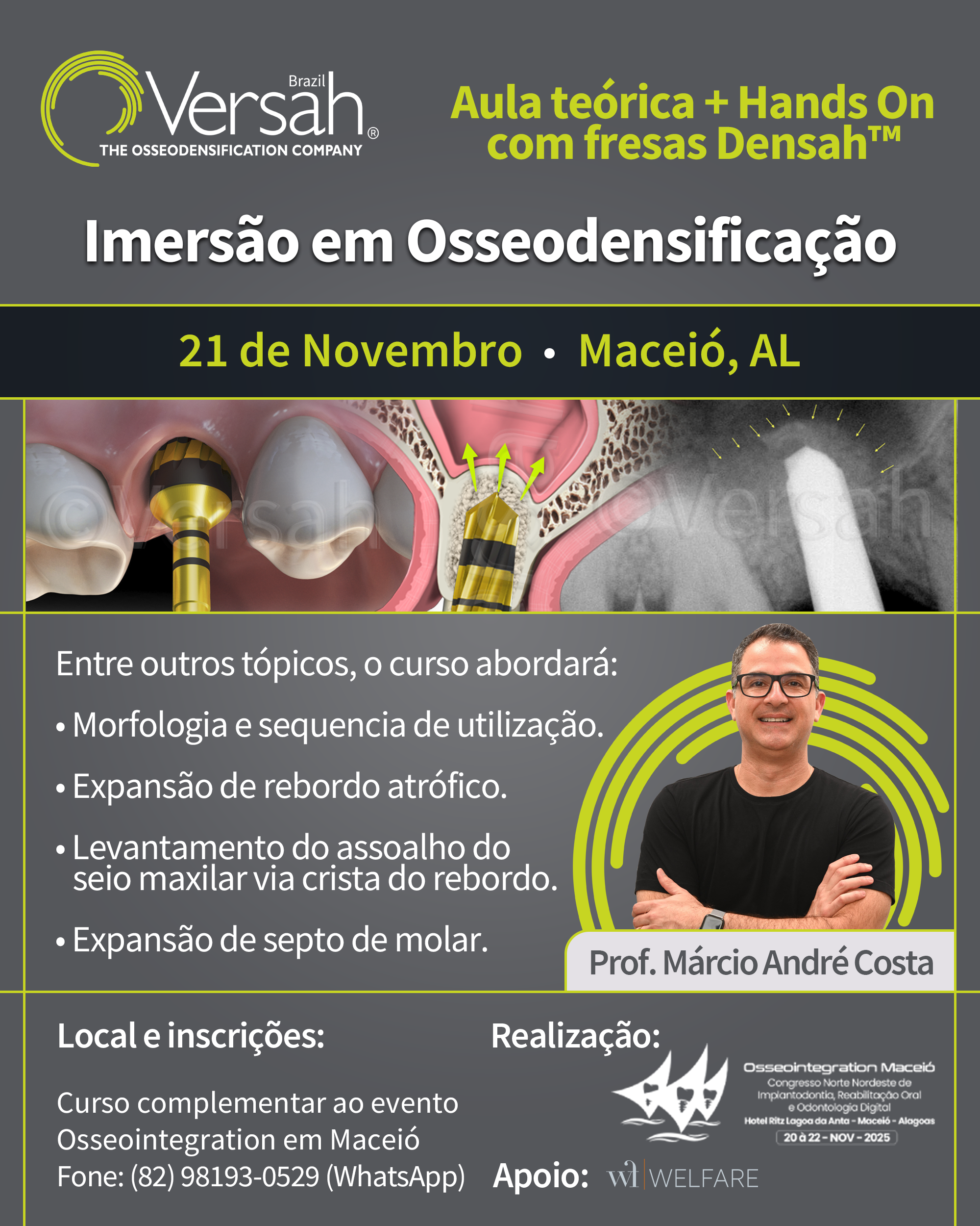 Osseodensificação Osseointagration Congress