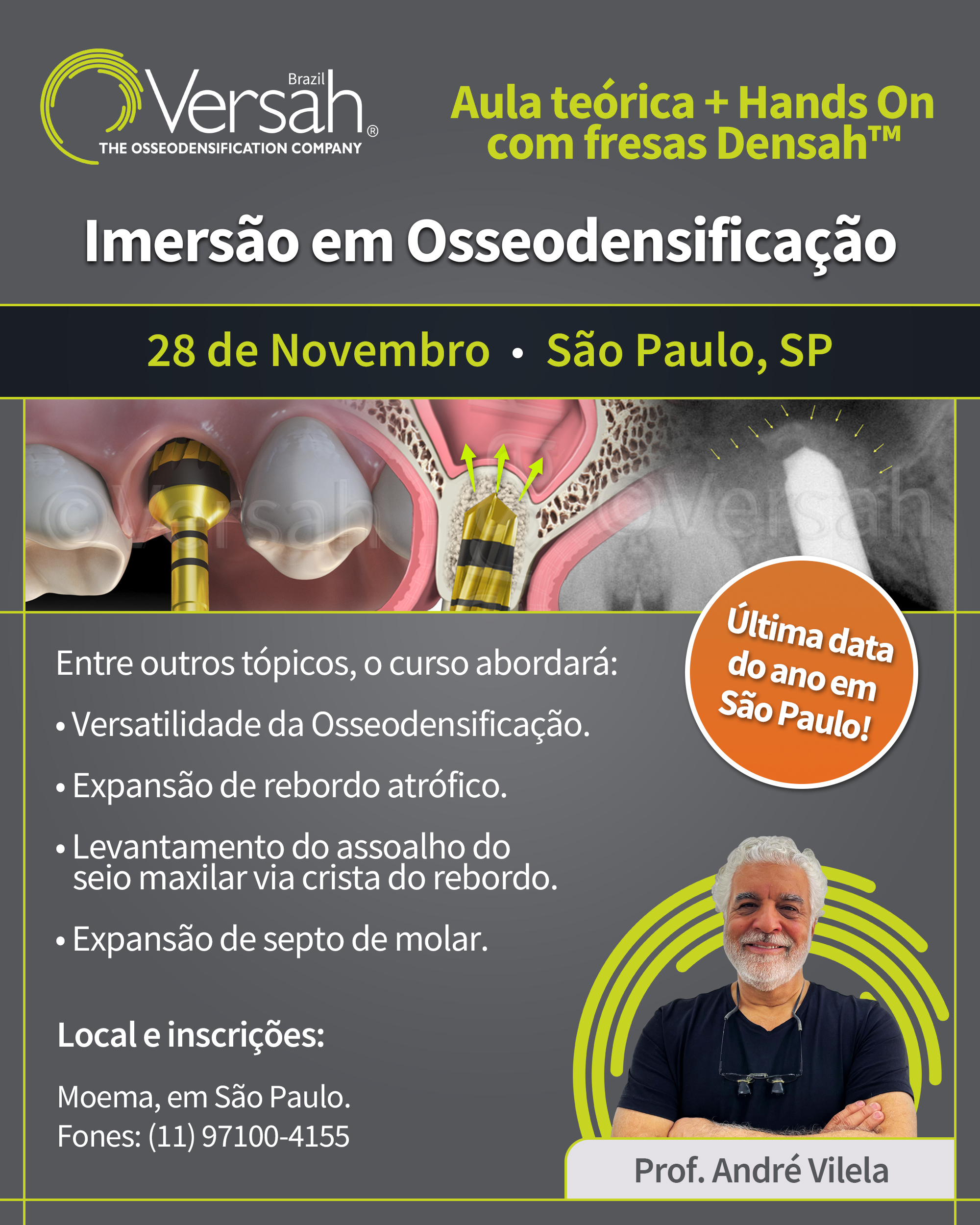Osseodensificação São Paulo