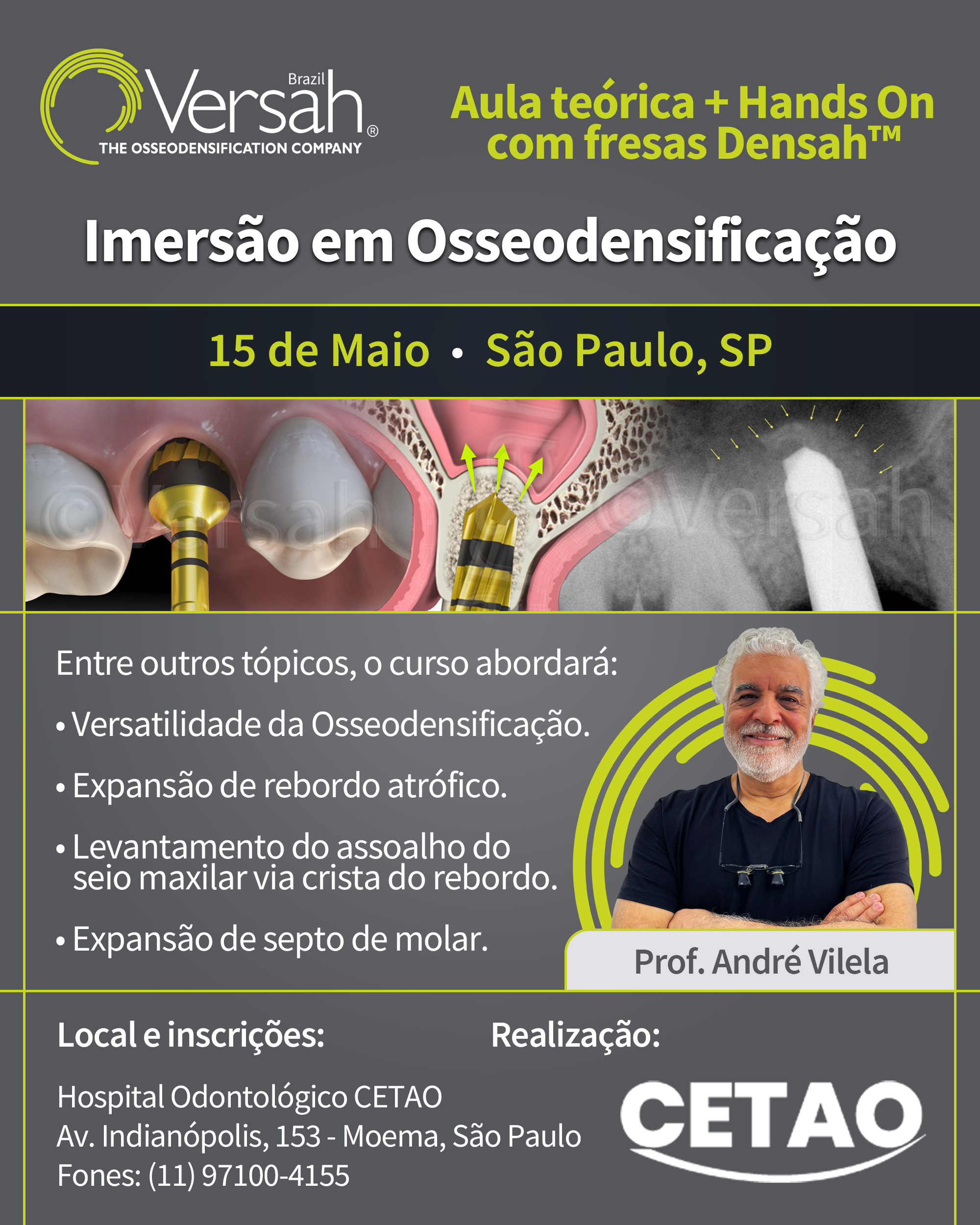 Osseodensificação Hospital Odontológico CETAO