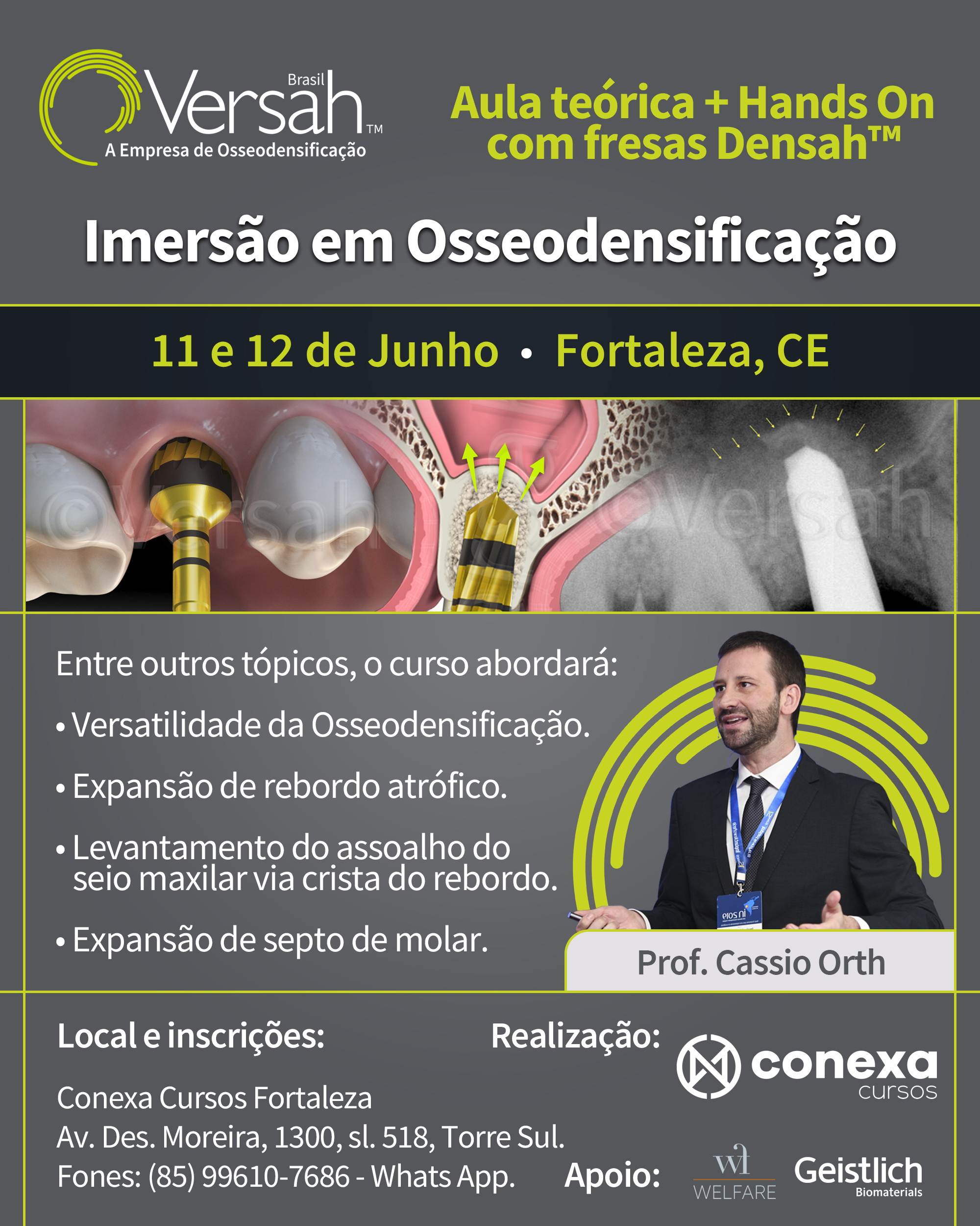 Osseodensificação Conexa Cursos