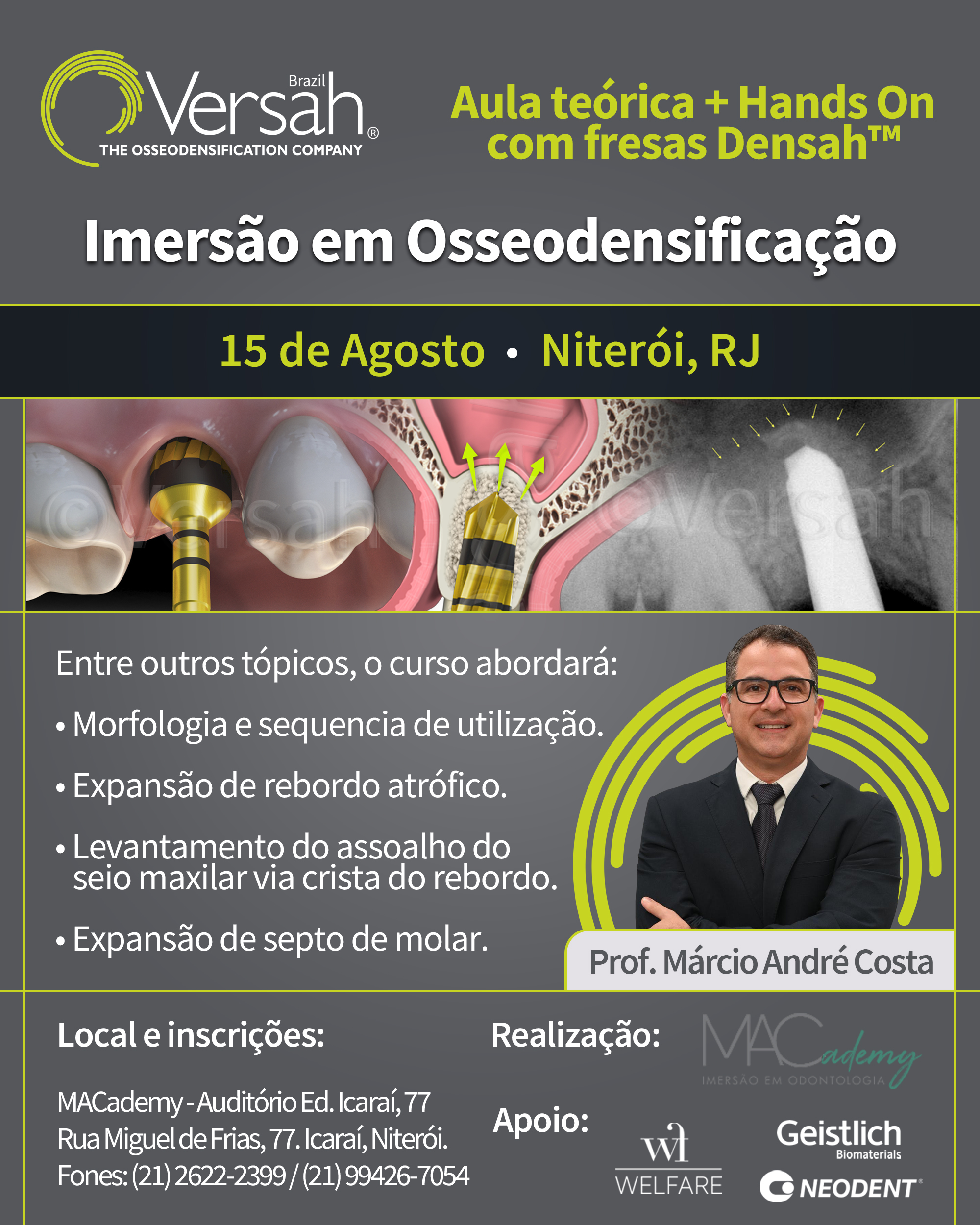 Osseodensificação Macademy Niterói