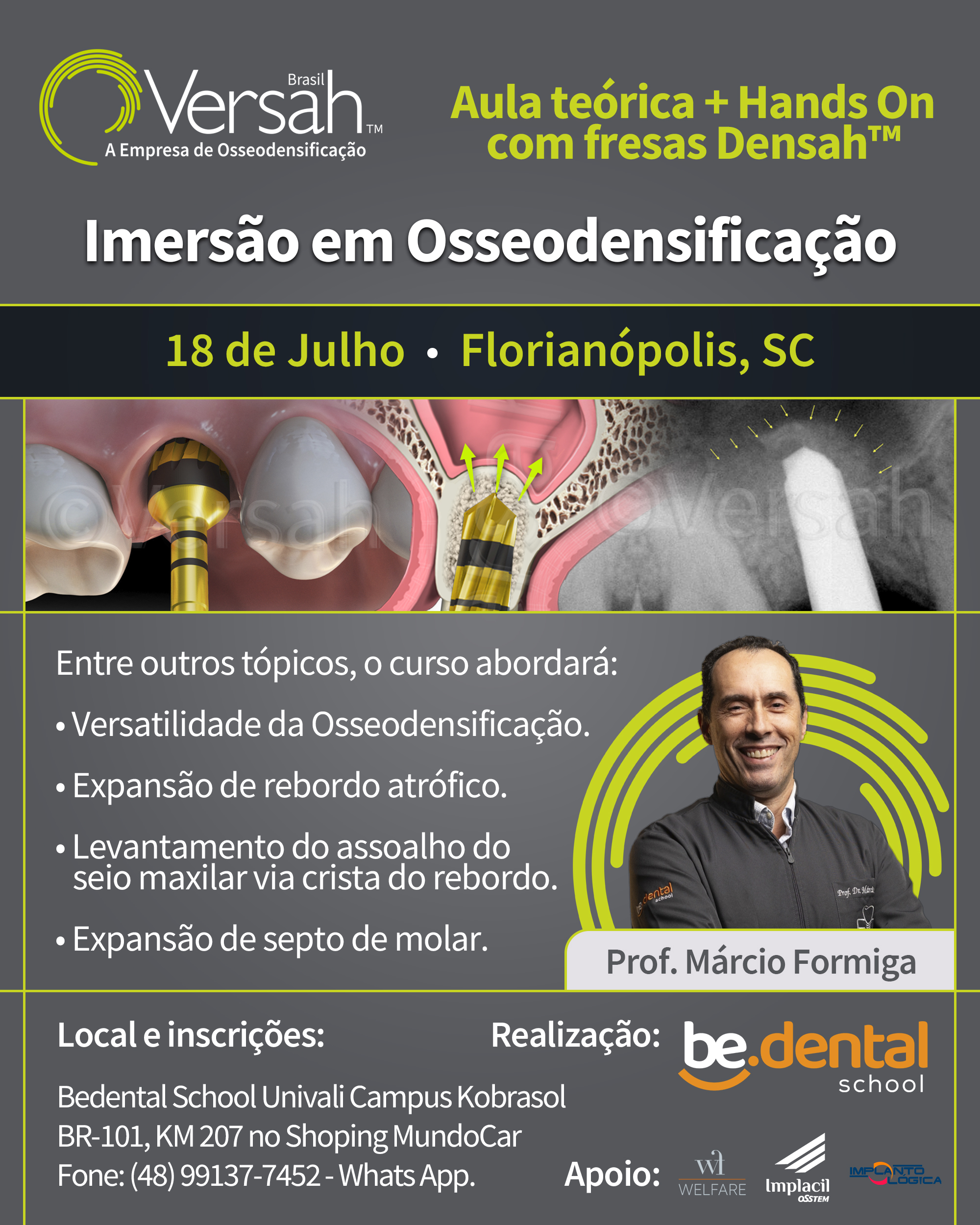 Osseodensificação Instituto Praxis