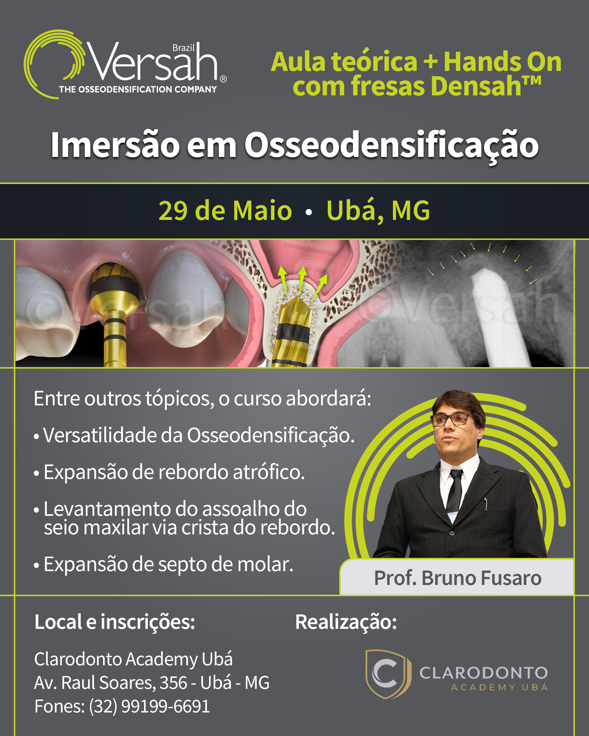 Osseodensificação Clarodonto Ubá
